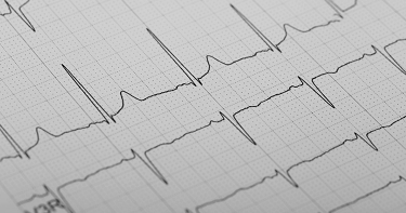 ECG